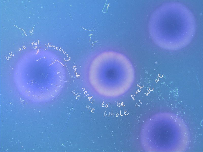 Gut microbe microscope photo with the words: we are not something that needs to be fixed, we are whole as we are